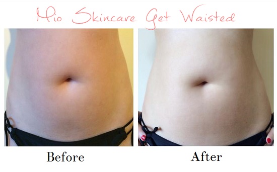 Mio Get Waisted Fat Burning Cream Before and After