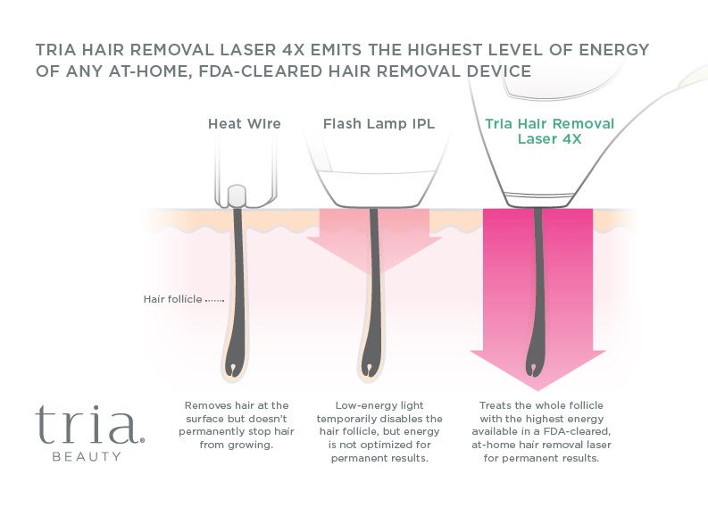 laser hair removal technology comparison chart